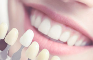 Mejor clínica dental estética