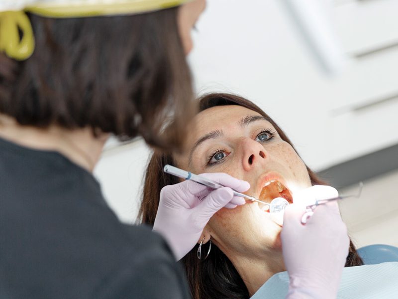 Qué son los implantes dentales